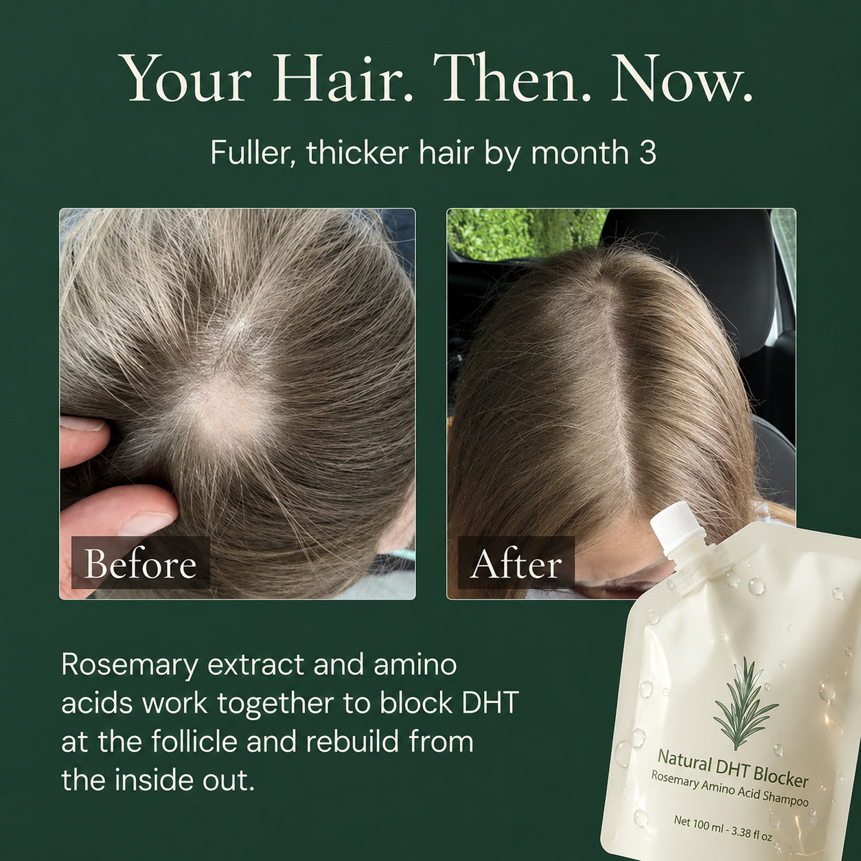 Rosemary Hair Growth Shampoo✨