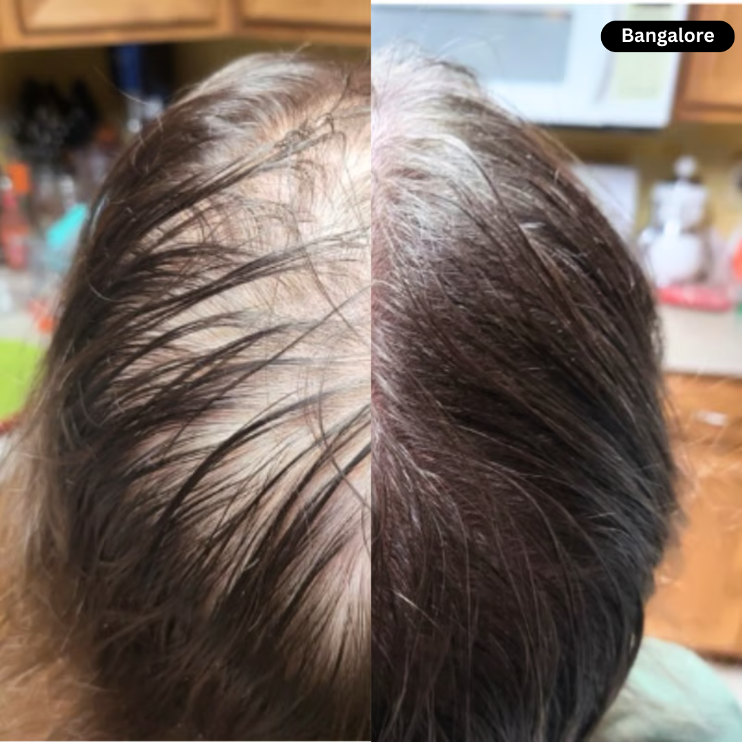 Pryxo hair care progress collage