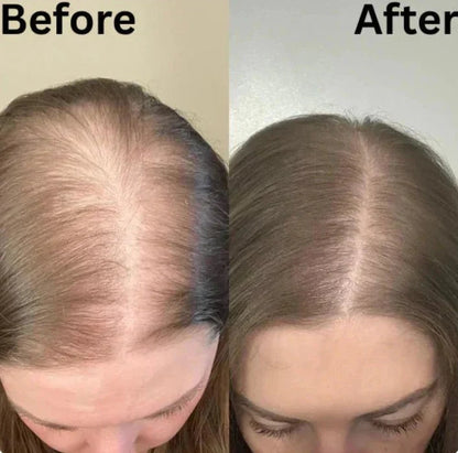 Rosemary Hair Growth Shampoo✨