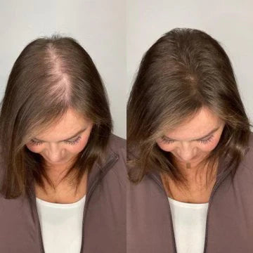 Rosemary Hair Growth Shampoo✨