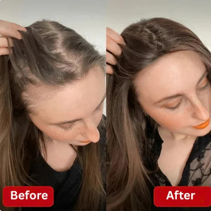 Rosemary Hair Growth Shampoo✨